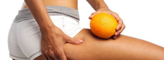 Cellulite: rimedi per eliminarla